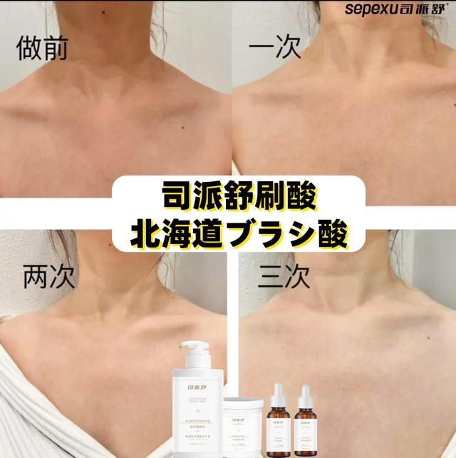 试下司派舒北海道全身刷酸pg电子平台拒绝黑黄粗糙(图1) 试下司派舒北海道全身刷酸pg电子平台拒绝黑黄粗糙(图1)